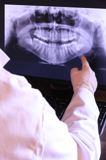 Best Emergency Root Canal Treatment in Linden, TX