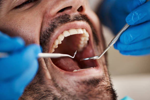 Best Urgent Care for Lost Fillings or Crowns in Linden, TX